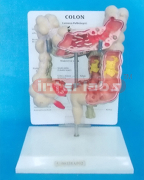 DESK TYPE COMMON PATHOLOGIES OF THE COLON MODEL WITH DESCRIPTION PLATE